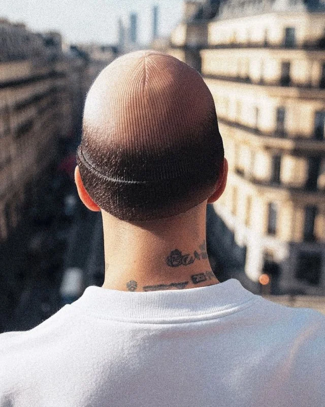 Шапки с "лысиной" завирусились в соцсетях (4 фото)